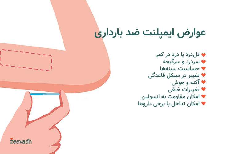 ایمپلنت ممکن است باعث دلدرد، سردرد، حساسیت سینهها و آکنه شود.